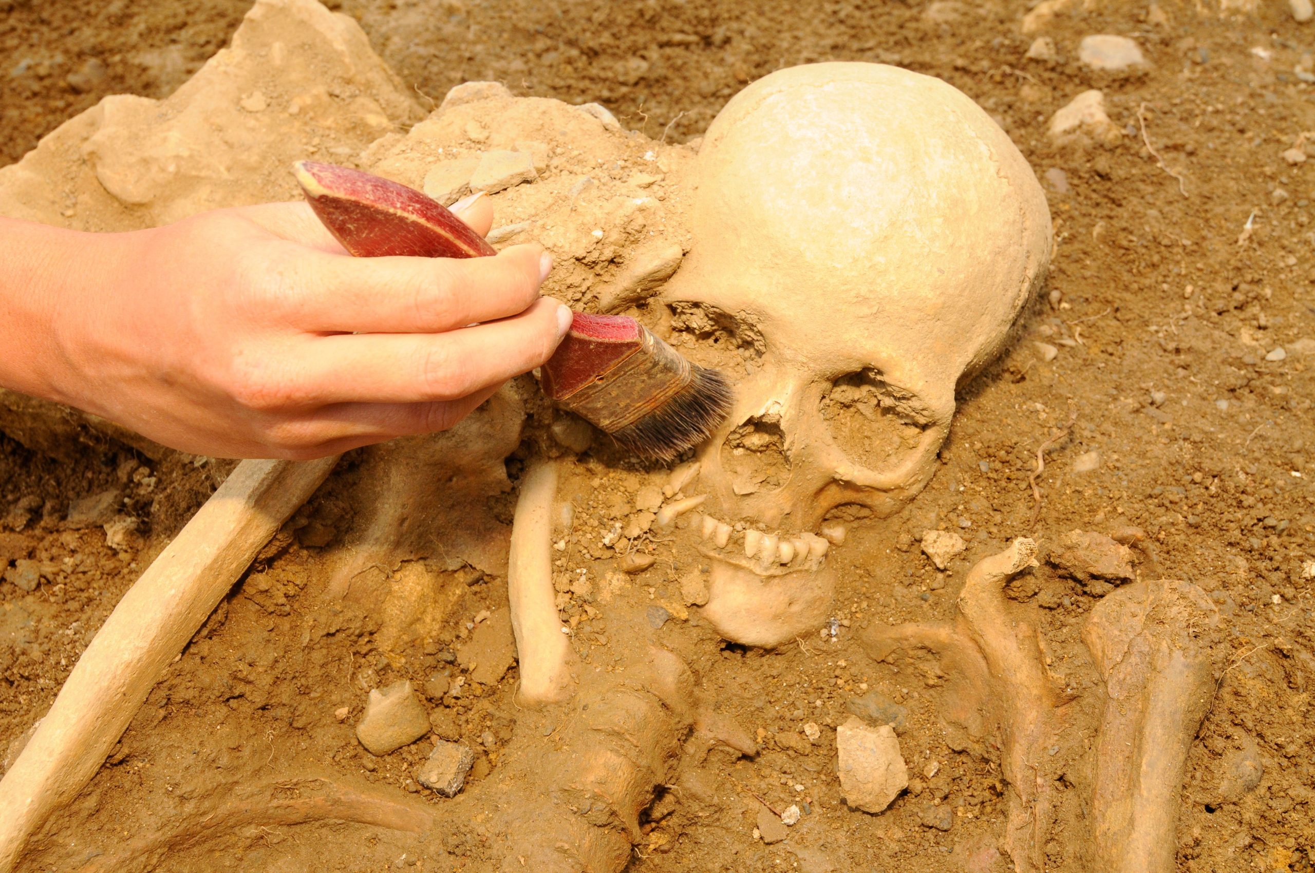 O esqueleto medieval lança luz sobre os cuidados de saúde da Suécia para deficientes